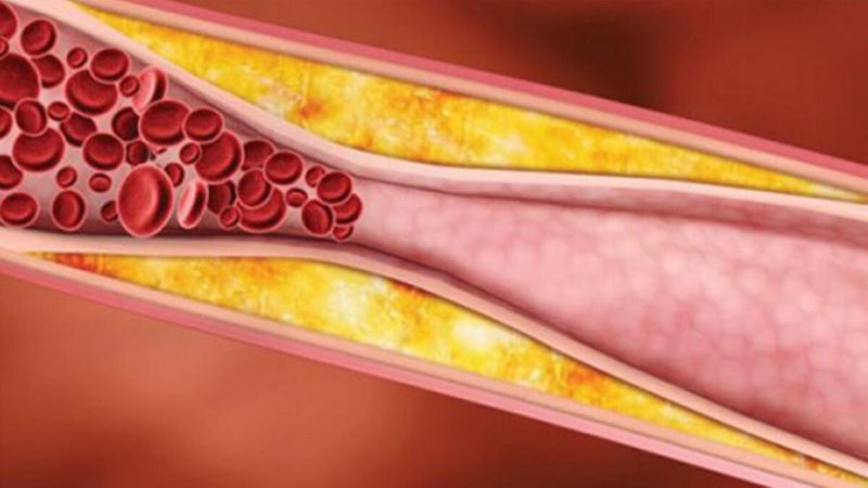 Trigliserid seviyelerini düşürmek için ipuçları