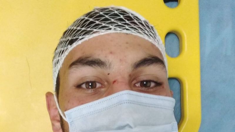 Sivas’ta düğün konvoyunun önünü kesince saldırıya uğradılar