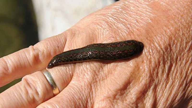 Erciyes Üniversitesi'nde sülükten kanser aşısı geliştiriliyor