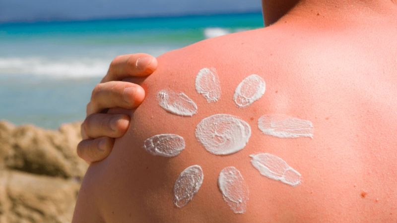 Tatiliniz eziyete dönüşmesin: Güneş yanığı acısına ne iyi gelir?