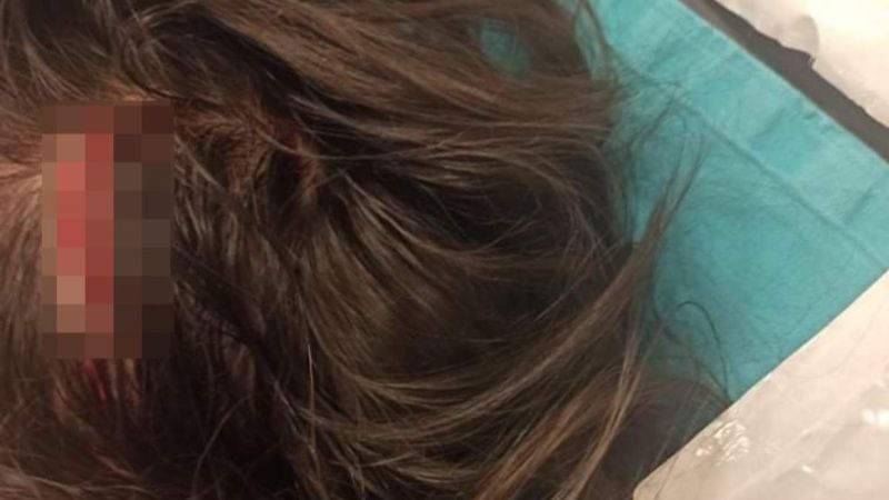 Afyonkarahisar'da sokak köpeği çocuğa saldırdı