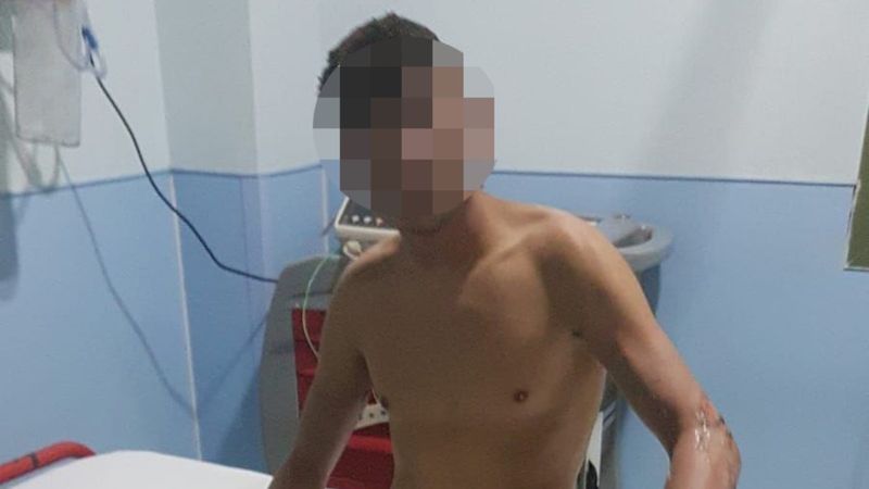 Arnavutköy'de konteynerde çakmak gazı patladı: 3 yaralı