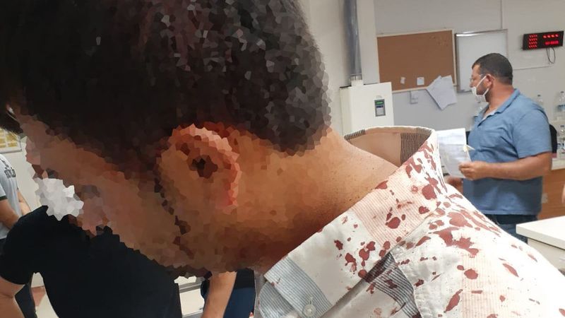 Şanlıurfa ve Mardin'de elektrik kesintilerine direnç gösteren gruplar çalışanlara saldırdı