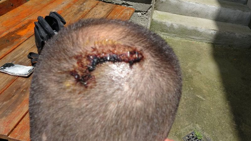 İstanbul'da beyzbol sopalı gaspçılar dehşet saçtı