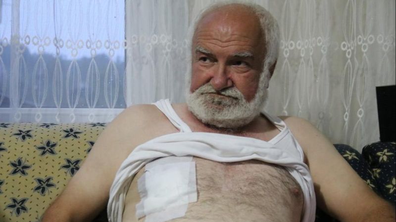 Rize'de bahçede çalışırken yorgun mermi ile vuruldu