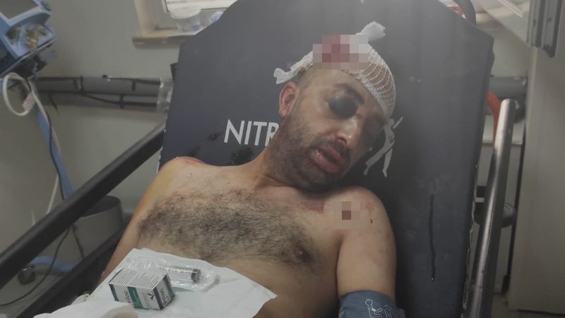 Bursa'daki adam, otomobille ezilerek öldüresiye dövüldü