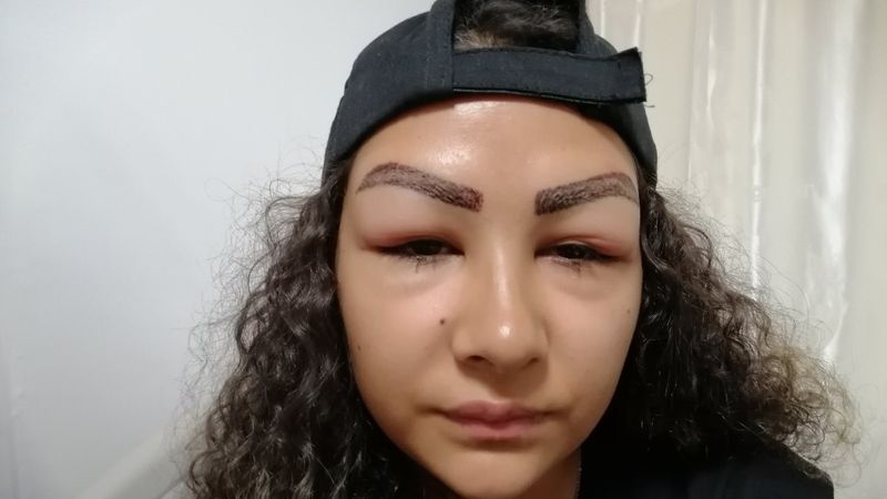 Aksaray'da reklam yüzü olmaya gitti, hastanelik oldu