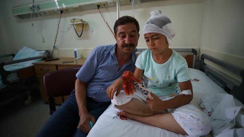 Balıkesir'de 8 yaşındaki kız, pitbull saldırısına uğradı