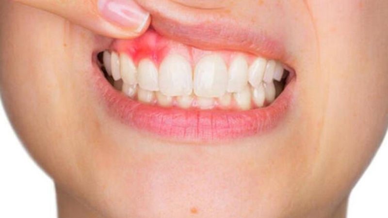 Kan şekeri yüksekliğinin sağlığa 6 etkisi