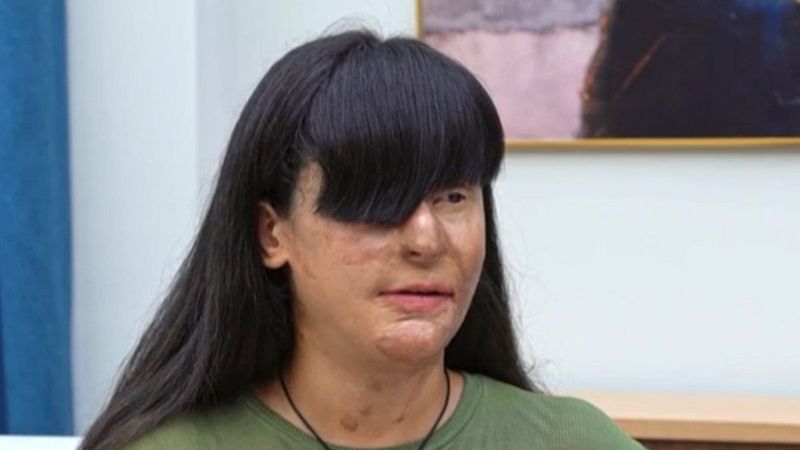 Berfin'in hikayesi herkesi ağlattı! Berfin Özek kimdir? Paylaş Benimle Berfin Özek'in biyografisi