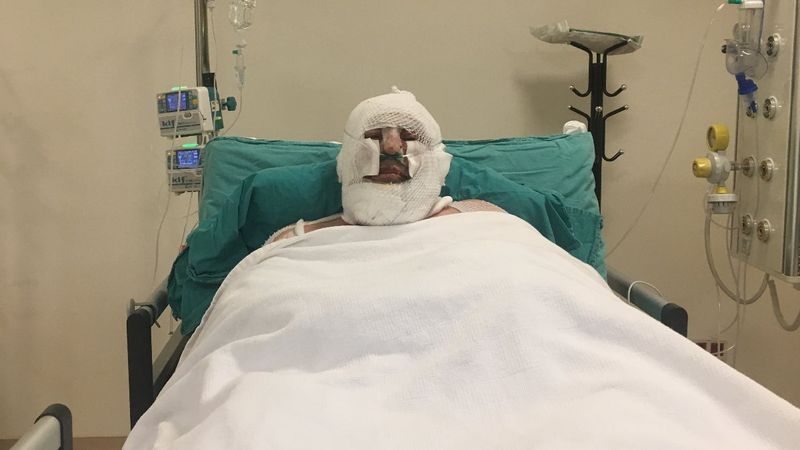 Denizli'de alevlerin arasında kalan kahraman ormancı o anları anlattı