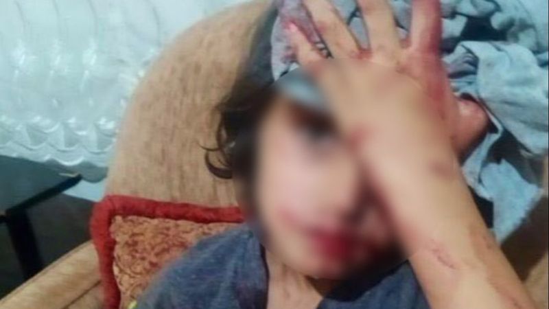 Ankara’daki saldırıda yaralanan çocuk tedavi altına alındı