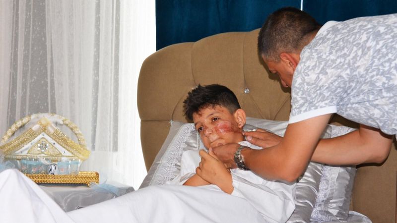 Erzurum’da çocuklar, bahşiş almak isterken ölüme neden oluyordu