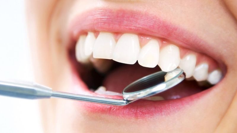 Diş taşlarını temizlemenin 6 doğal yolu