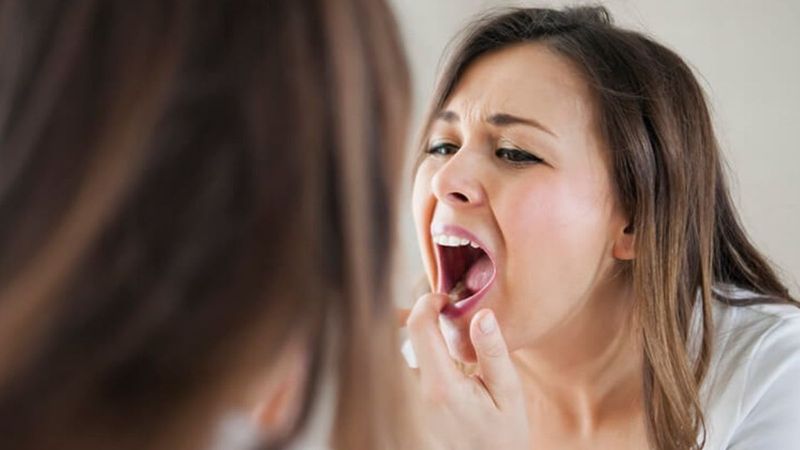 Ağızdaki yaralar dil kanseri işareti olabilir