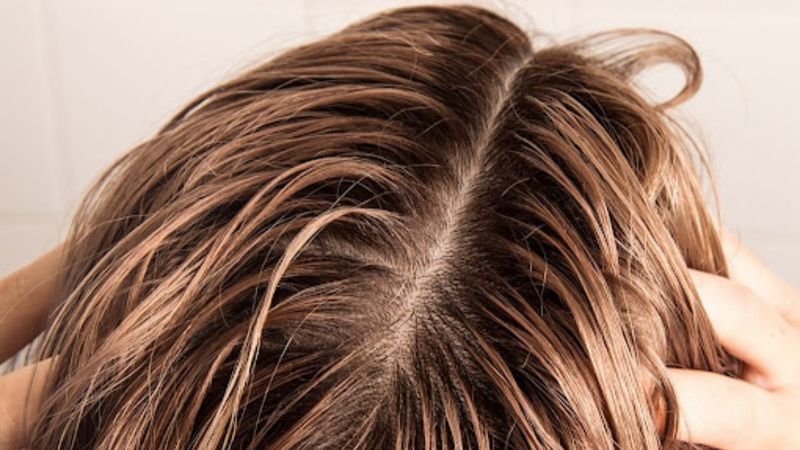 Yağlı saçları anında kamufle etme yolları