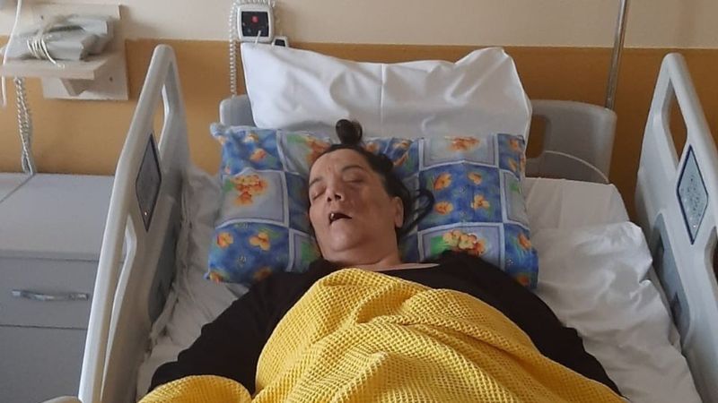 Kocaeli'de siniri kesilince yüz felci geçiren kadın öldü