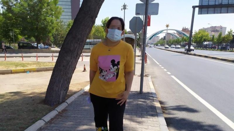 Gaziantep'te bir kadın, boşanmak istediği eşi tarafından darbedildi