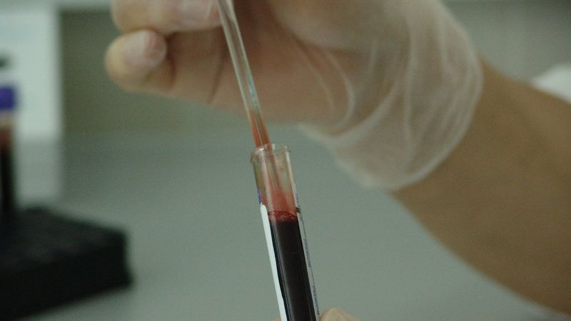 Kan zehirlenmesi her yıl 10 milyon can alıyor