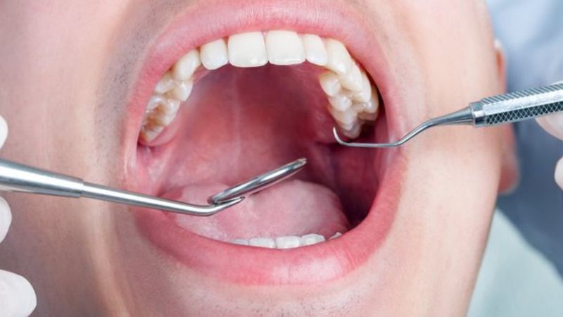 Damak yaralarını tedavi eden 7 yöntem