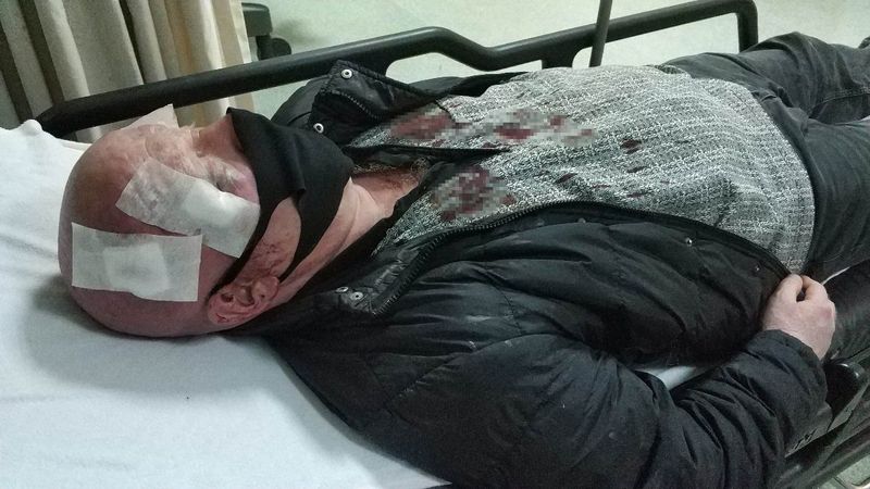 Samsun'da zurnacıyı hastanelik edip 10 bin lirasını gasbettiler