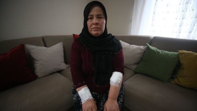 Düzce’de pitbull saldırısına uğrayan kadın: Sesimi duyuramadım