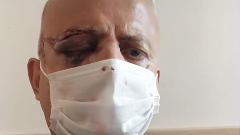 Avcılar'da metrobüste maske kavgası kör etti