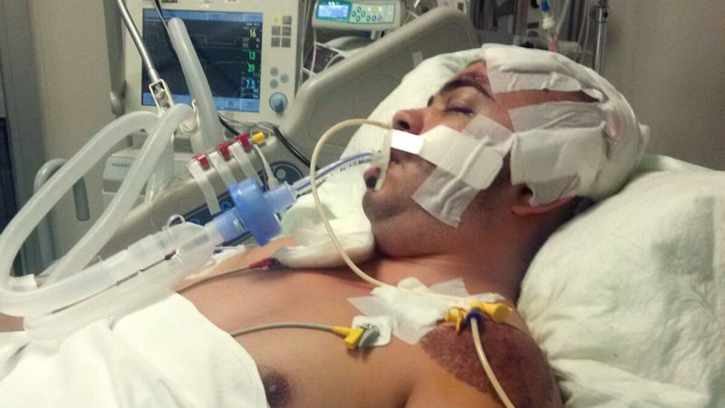 Antalya'da 752 gün komada kalan Semih, hayata tutundu