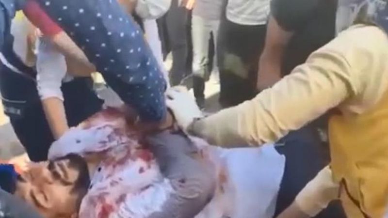 Şanlıurfa'da 'yol verme' kavgası: 1 ölü