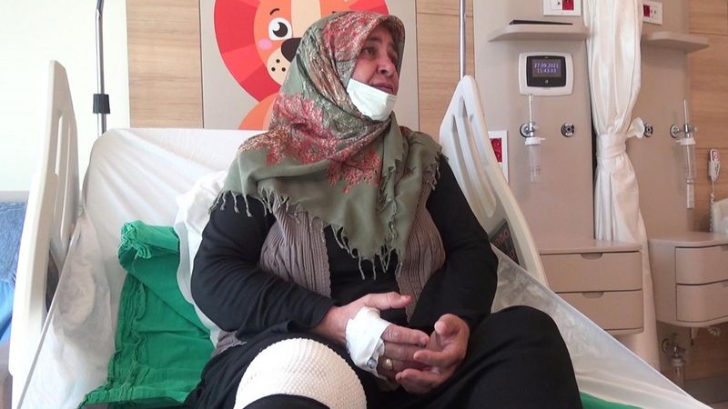 Ağrı’da kulaktan dolma tedaviyi uygulayan kadının dizi yandı