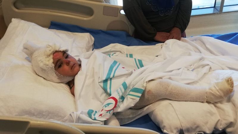 Erzurum’da, tandıra düşen 2 yaşındaki çocuğun vücudu yandı