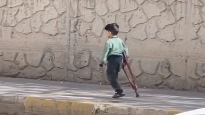 Mardin’de, 5 yaşındaki Muhammed için kaymakamlık protez sipariş etti