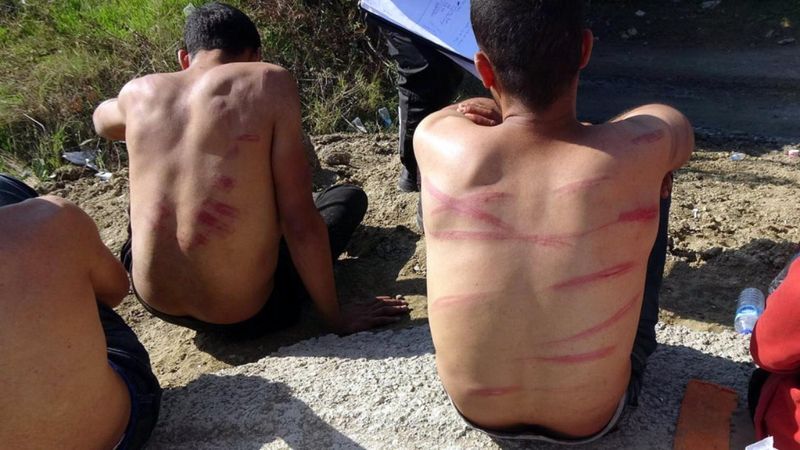 Yunanistan, para ve kıyafetlerini aldığı göçmenleri dövüp, Türkiye'ye itti