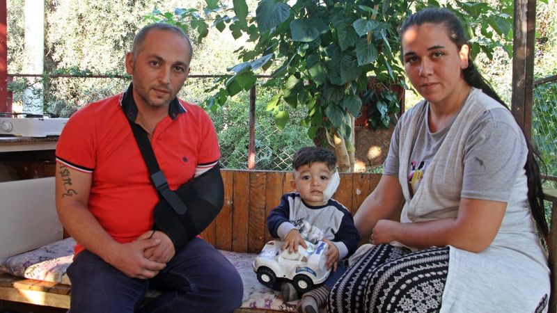 Antalya’da pitbull, 11 aylık bebeğe ve babasına saldırdı