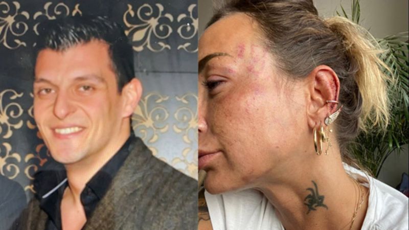 Bursa'daki kadın uzaklaştırma kararı aldırdığı eski sevgilisi tarafından darbedildi