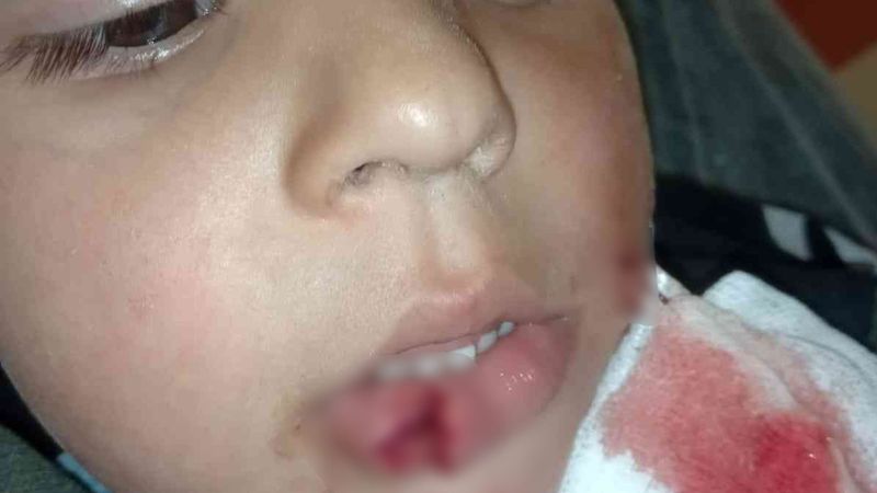 Kastamonu'da köpek saldırısına uğrayan 3 çocuktan 1'i ağır yaralı