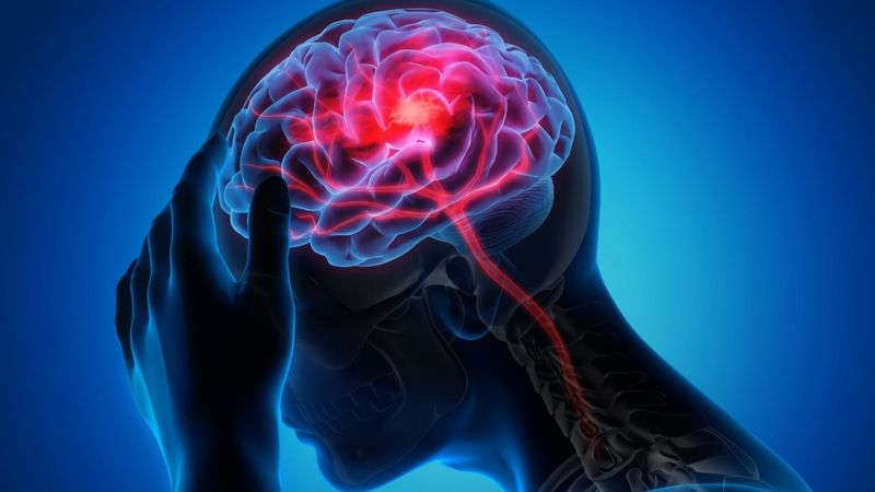 İklim değişikliği inme riskini artırıyor