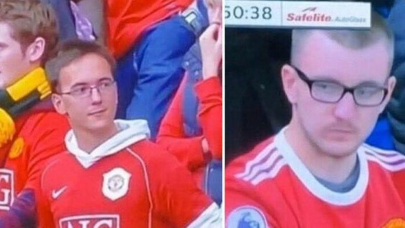 M. United taraftarı saçının dökülmesinden kulübü sorumlu tuttu