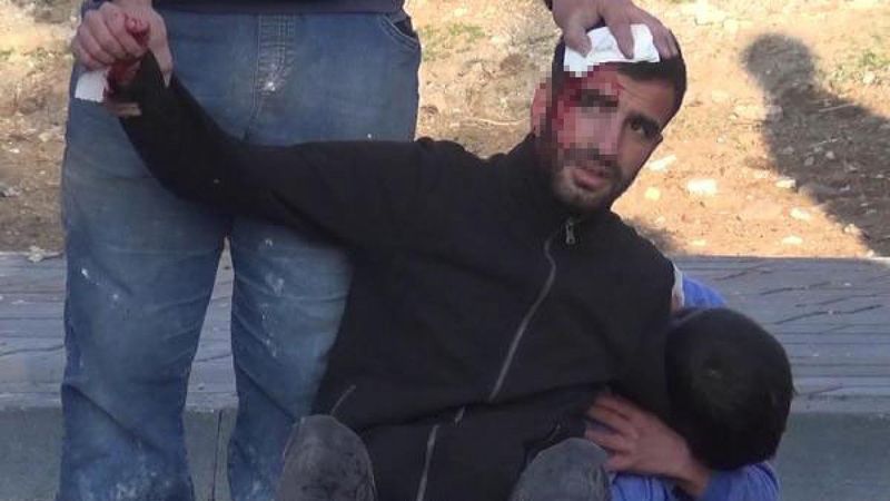 Erzurum'da düğün öncesi kısır gecesi hazırlığında kavga