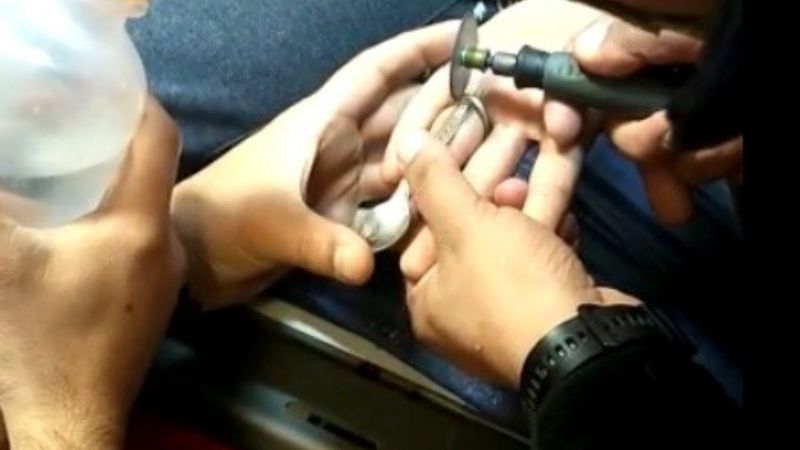 Aydın'da madeni paradan yapılan yüzük hastanelik etti