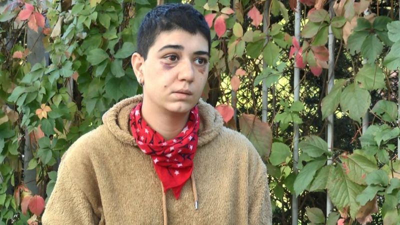 İstanbul'da vahşice darbedilen genç kadın felç geçirdi