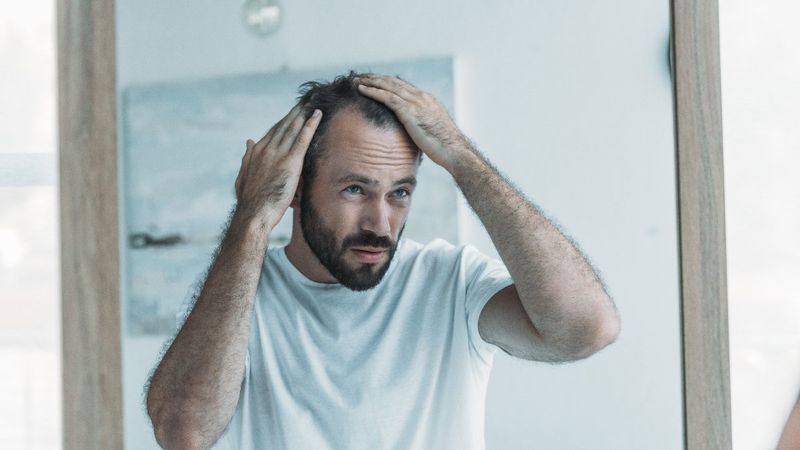 Anormal saç dökülmesinin 5 nedeni