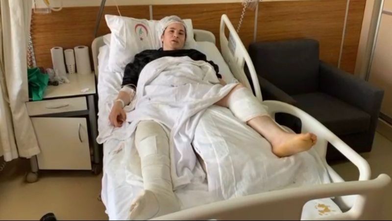 Üsküdar’da boşandığı eşi tarafından vurulan kadın: Ölmek istemiyorum