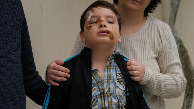 Başıboş sokak köpekleri 2 günde 2 çocuğa saldırdı