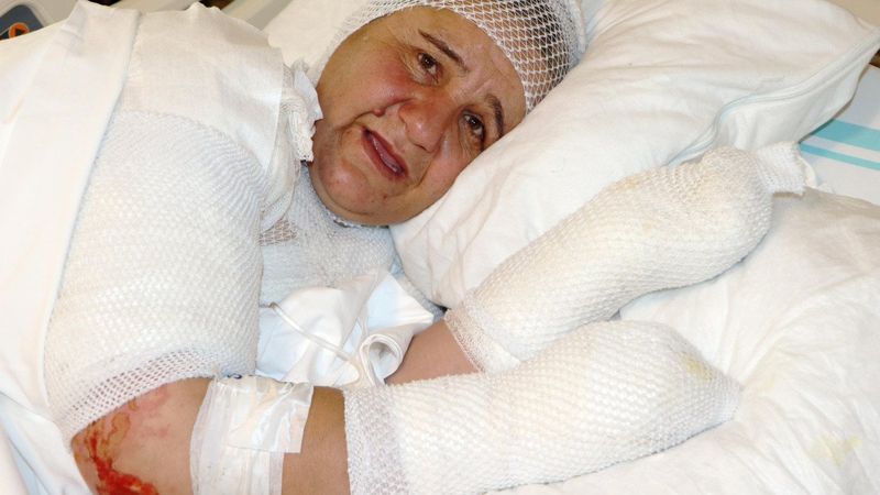 Muş’ta, ekmek pişirirken tandıra düştü