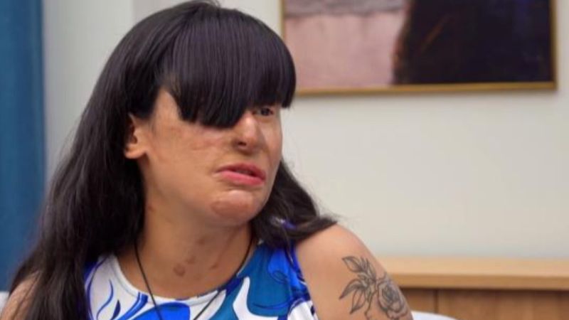 'Aynısını acımadan yaparım' demişti! Berfin Özek yüzüne kezzap atan Ozan Çeltik'i neden affetti?