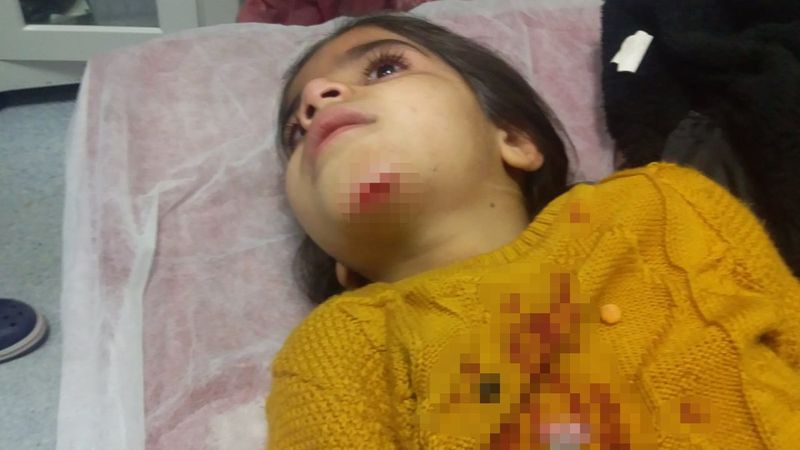 Diyarbakır'da küçük kız, belediye çukuruna düştü