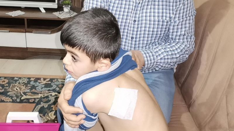 Kayseri'de çocuğu köpeklerden kurtaran kahraman kadın aranıyor