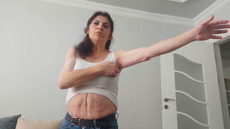 İzmir’de 3 kez bıçak altına yatan kadın, estetik mağduru oldu