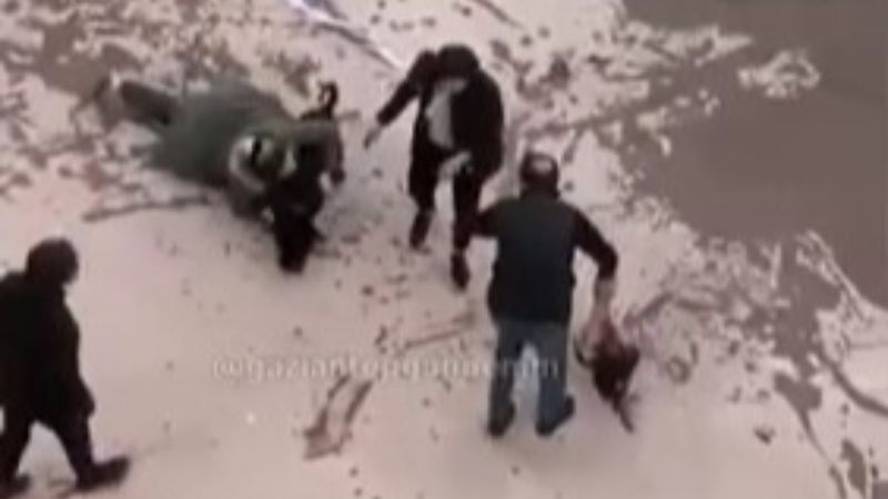 Küçük bir çocuk daha pitbull yüzünden yaşam savaşı veriyor